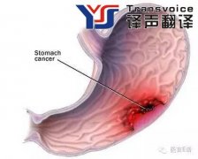 醫(yī)學(xué)翻譯：消化科——胃癌